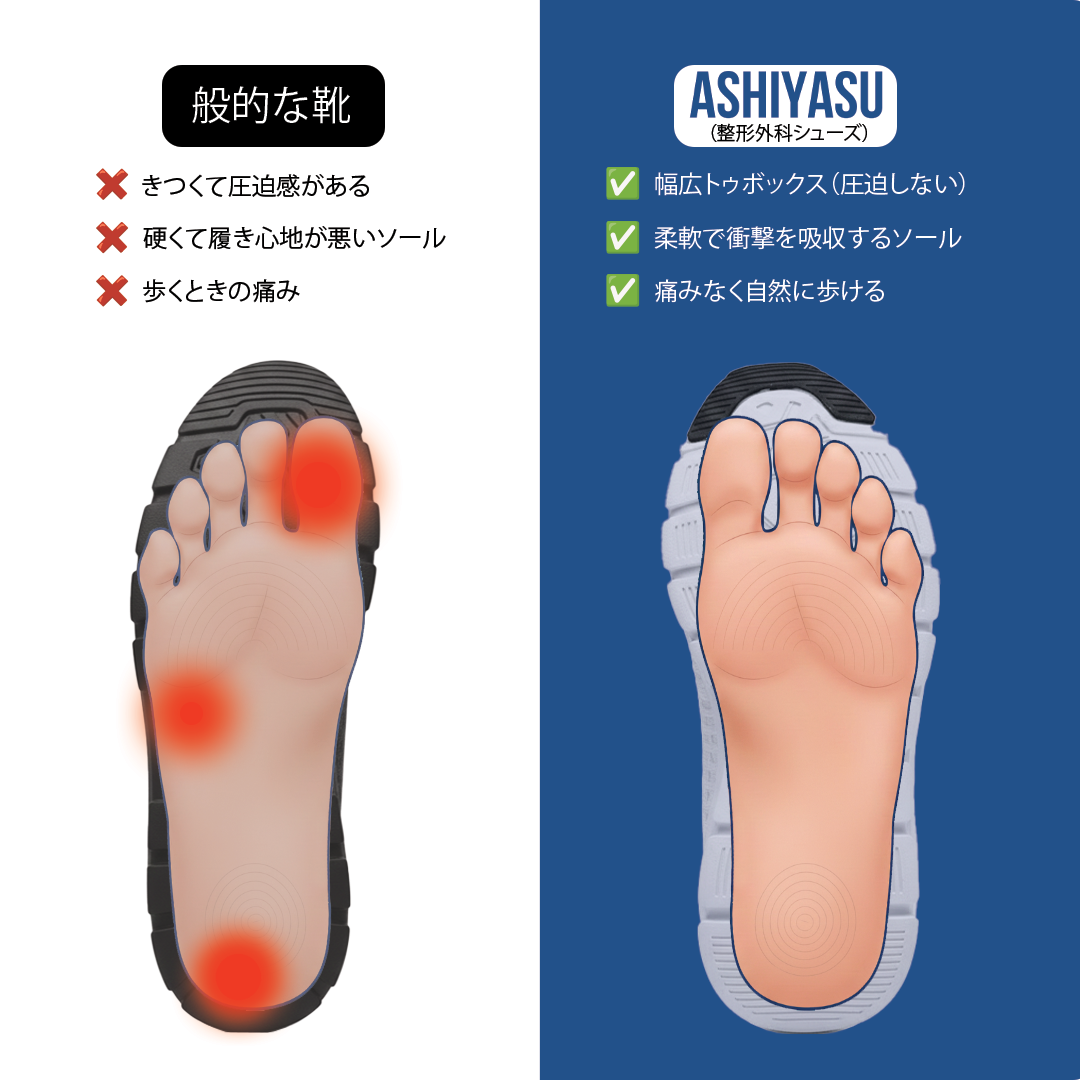 KOKOCHI整形外科用スニーカーPRO 2.0